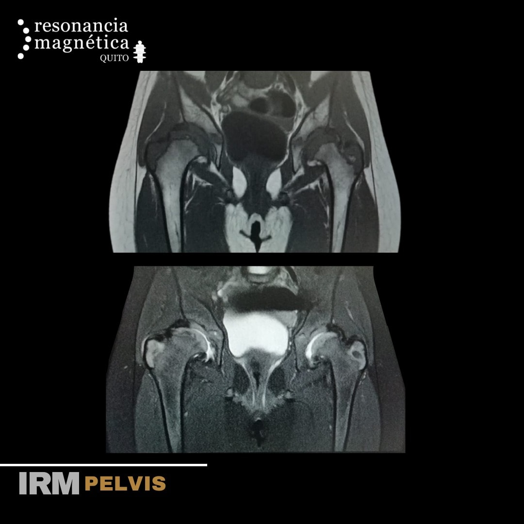 Download free bootstrap 4 admin dashboard, free boootstrap 4 templates