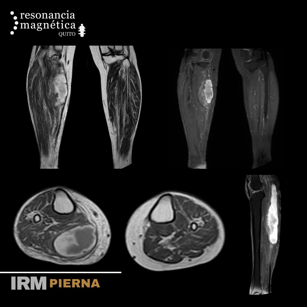 Download free bootstrap 4 admin dashboard, free boootstrap 4 templates