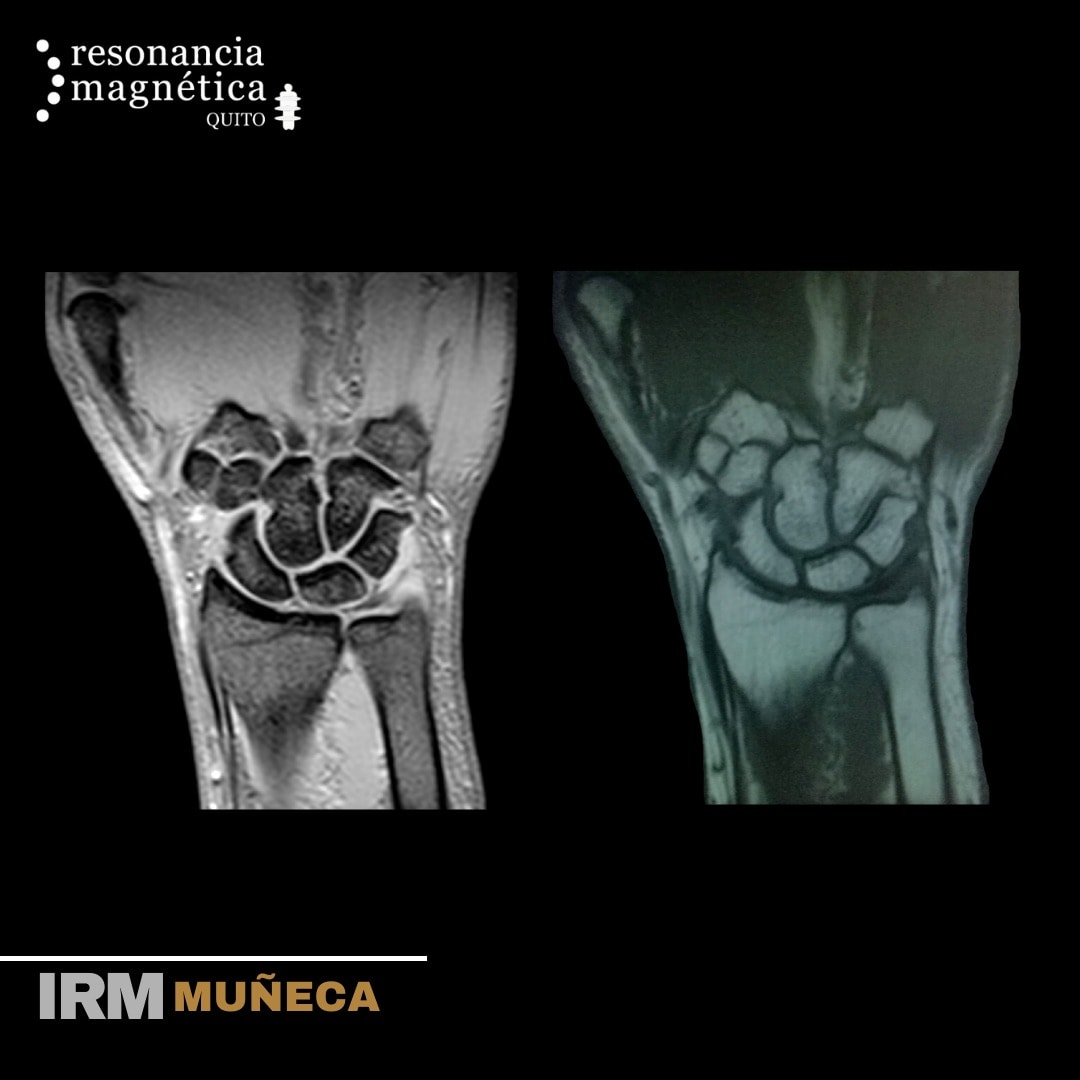 Download free bootstrap 4 admin dashboard, free boootstrap 4 templates