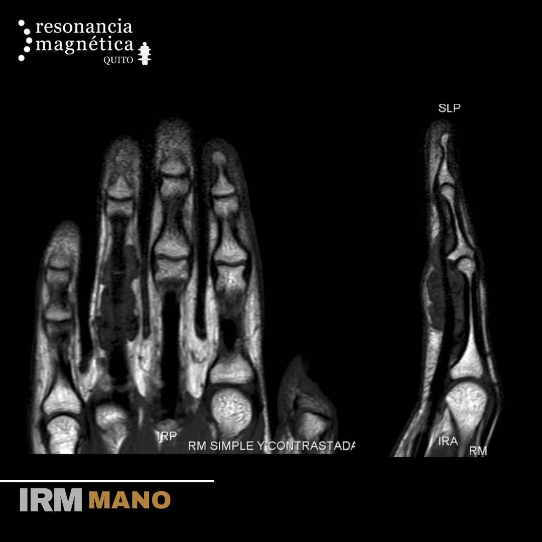 Download free bootstrap 4 admin dashboard, free boootstrap 4 templates