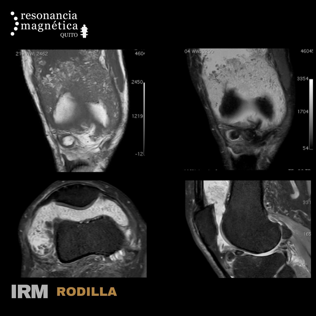 Download free bootstrap 4 admin dashboard, free boootstrap 4 templates