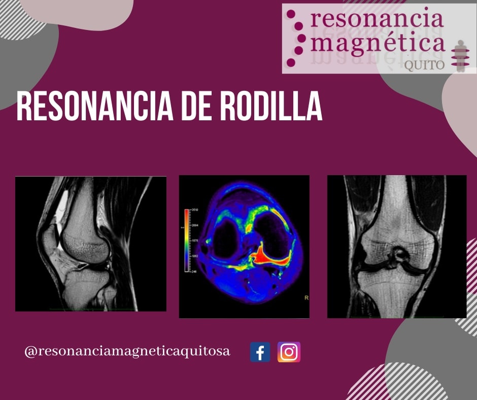 Download free bootstrap 4 admin dashboard, free boootstrap 4 templates