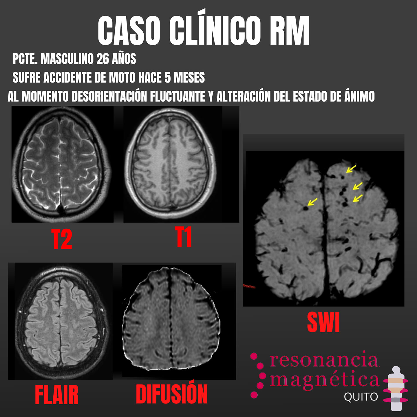 Download free bootstrap 4 admin dashboard, free boootstrap 4 templates