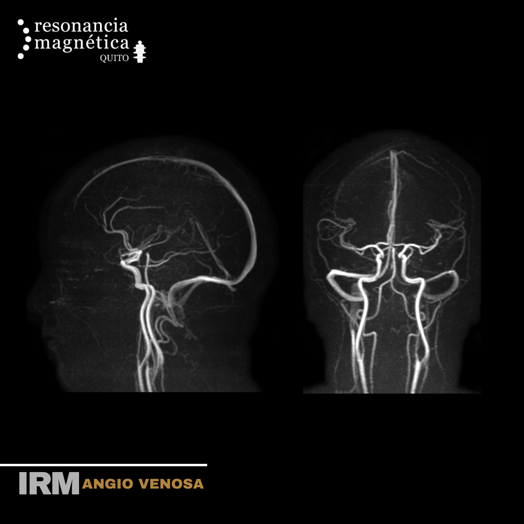 Download free bootstrap 4 admin dashboard, free boootstrap 4 templates